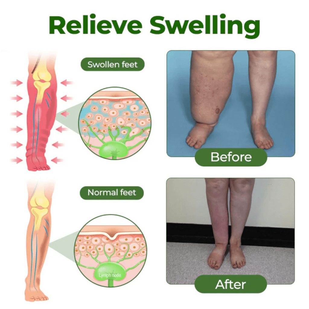 Leg Firming Lotion